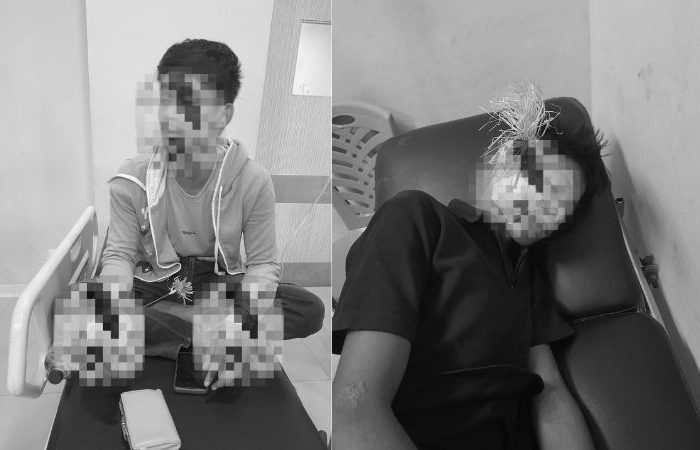 Dua remaja dilaporkan terluka akibat serangan busur panah. Rifki (20), warga Jalan Sungai Malino, mengalami luka serius di tangan kirinya setelah busur menancap cukup dalam. Sementara itu, Rangga (16)